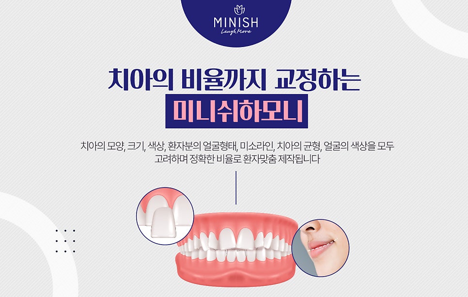 돌출입교정, 빠르게 치아의 비율까지 교정한다? 관련 이미지 5