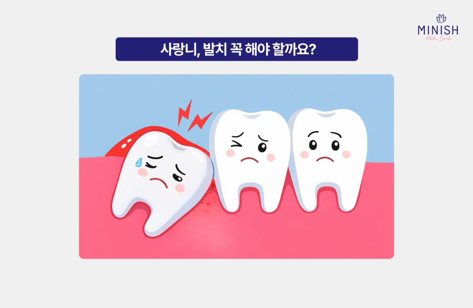 Do Wisdom Teeth Have to Be Extracted? image 3
