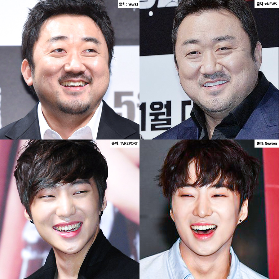 치아 콤플렉스? 치아성형 대신 미니쉬 관련 이미지 9