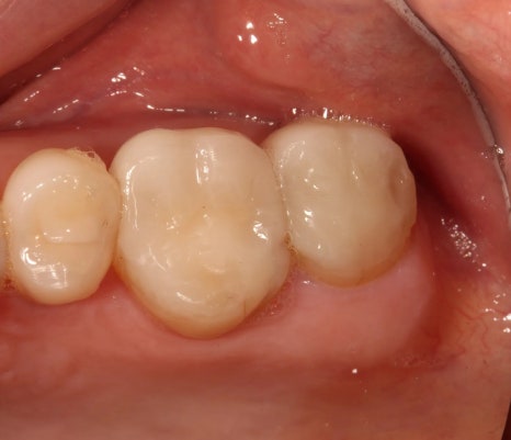 A 6-Year Minish Review from a Dentist, feat. Director Lee Jeong-eun image 7