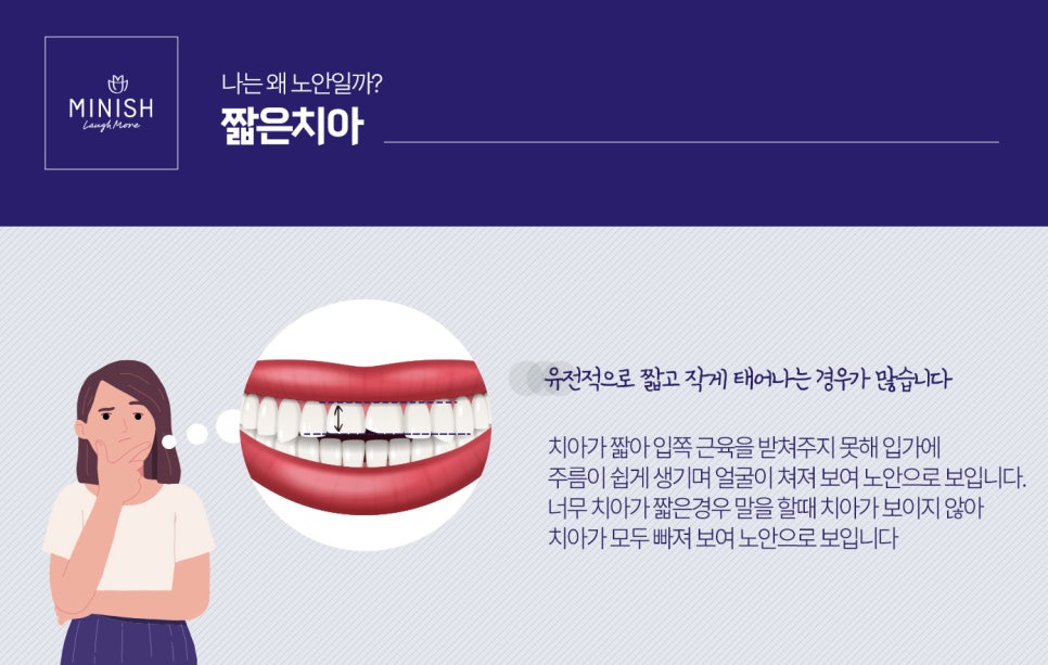 누렇고 짧은치아 개선법 관련 이미지 4