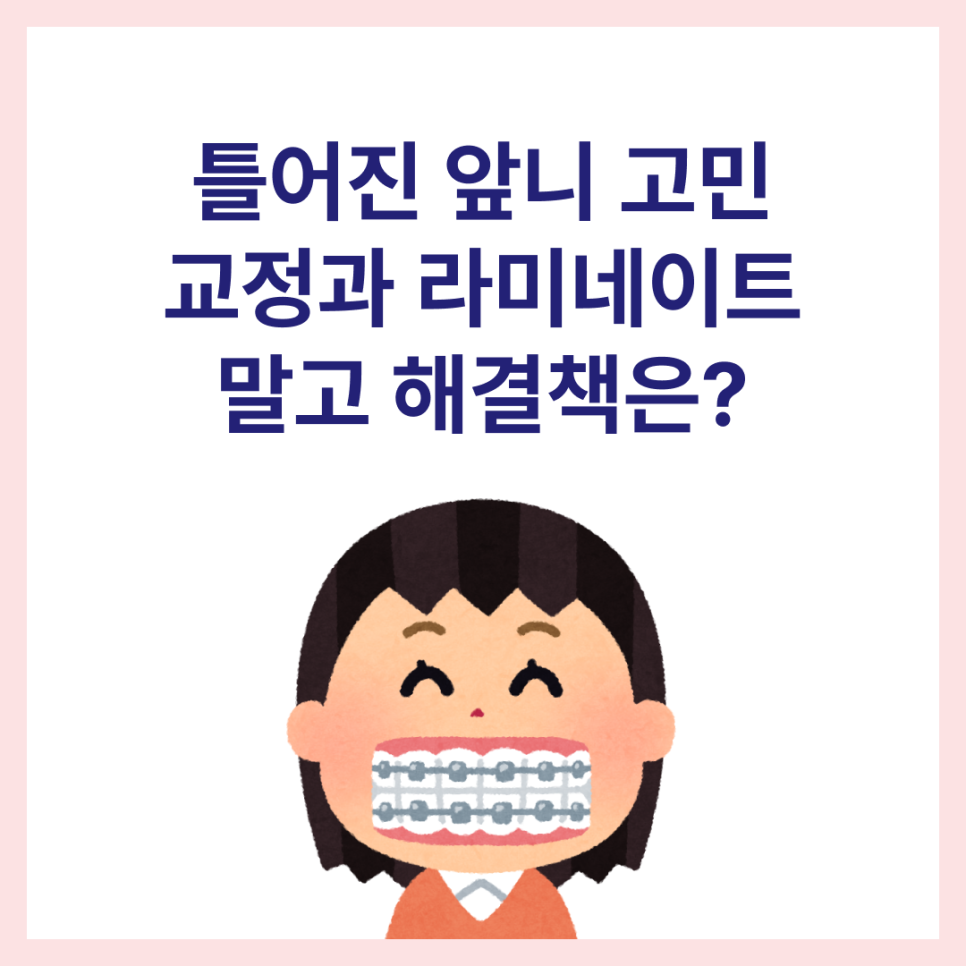 틀어진 앞니 하루만에 해결! (미니쉬, 라미네이트, 부분교정) 관련 이미지 1
