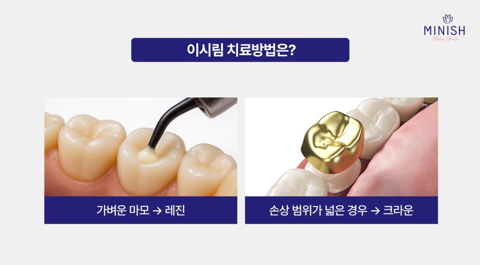 Cold Water Alone Makes Your Teeth Sensitive? A Complete Guide to Causes and Treatment! image 3