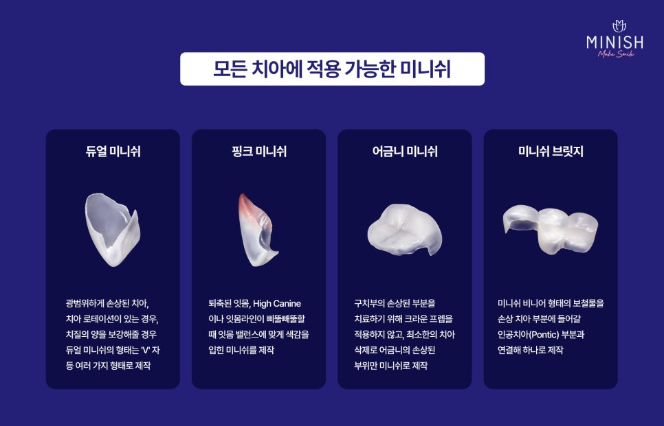 What Is the Technology Behind Minish’s Precise One-Day Restoration? It Comes from the Minish Dental Laboratory Research Center. image 14