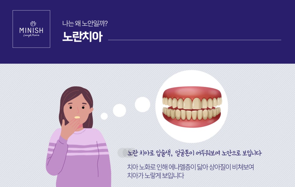 누렇고 짧은치아 개선법 관련 이미지 5
