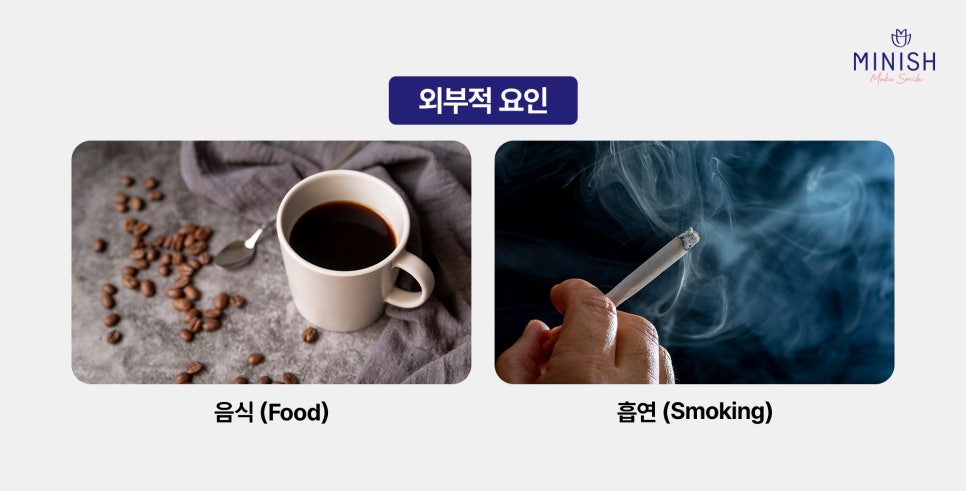 누런치아, 치아 미백으로 해결되지 않을 땐? 관련 이미지 2