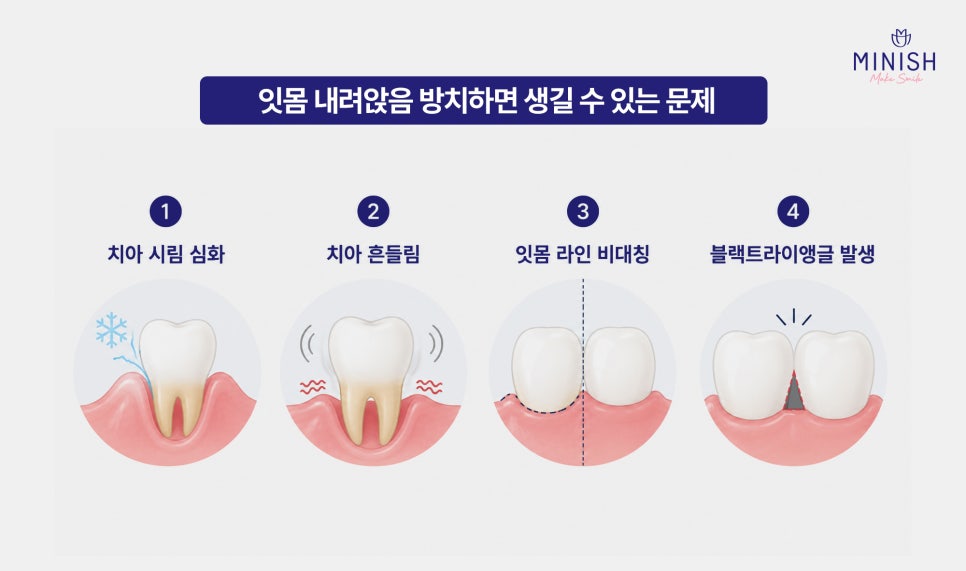 Causes of Receding Gums, Early Signs of Gum Disease, and When Gum Disease Treatment Is Needed image 5