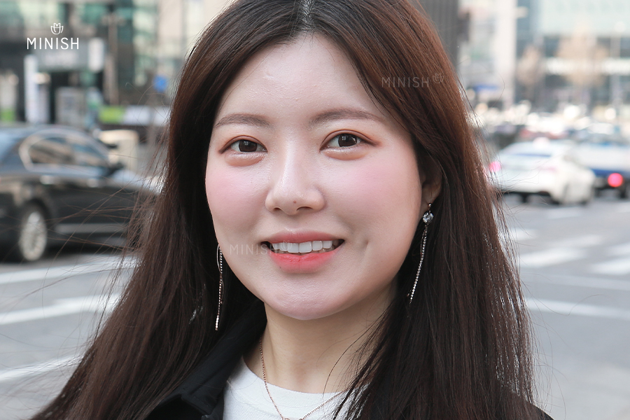 압구정 치과가 추천하는 벌어진치아 교정방법? 관련 이미지 6