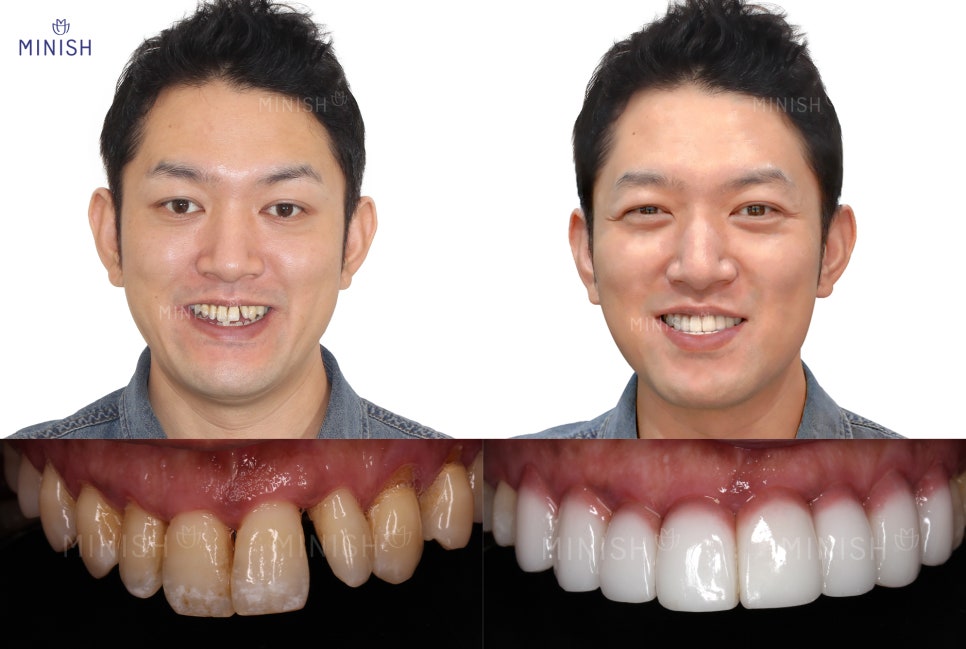 웨딩 스드메? 관련 이미지 2