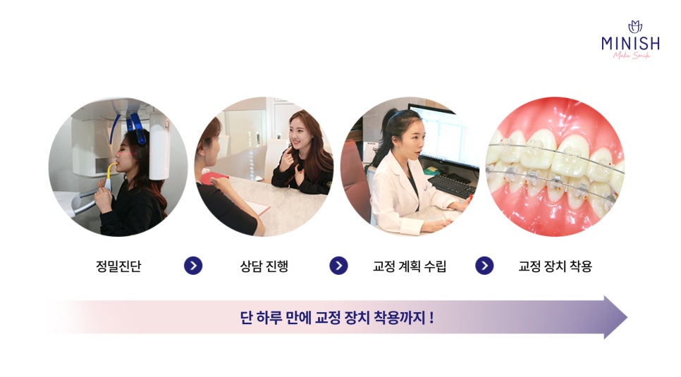 Types of Orthodontic Treatment at Minish Dental Hospital and How to Improve Aesthetics Too! image 6