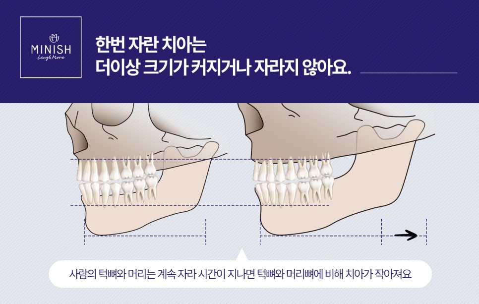 [치아상식] 그것이 알고 싶다 - 치아는 왜 두 번만 나는 걸까? 관련 이미지 3