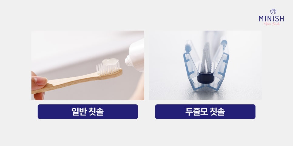 치아교정 양치질이 중요한 이유와 올바른 방법까지 알려드려요 관련 이미지 3