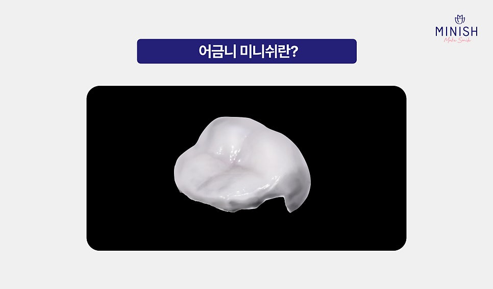 From Front Teeth to Molars, Which Minish Is Right for My Dental Condition? image 12