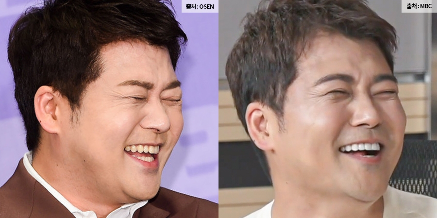 치아교정 고민, 미니쉬하모니로 관련 이미지 3