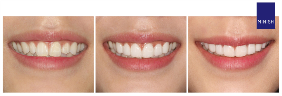 웨딩 스드메? 관련 이미지 3