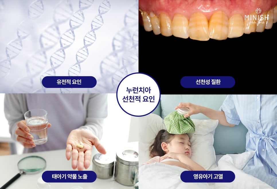 Yellow Teeth, From Causes to Solutions! Which Method Is Right for Me? image 2