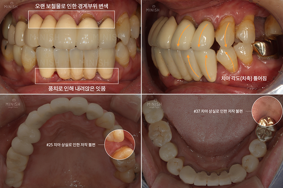꽃게엄마와 꽃게딸, 미니쉬로 찾은 행복한 미소 [엄마는예뻤다] 관련 이미지 16