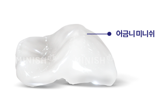 충치 근본 원인을 해결하는 미니쉬를 활용한 충치치료 관련 이미지 7
