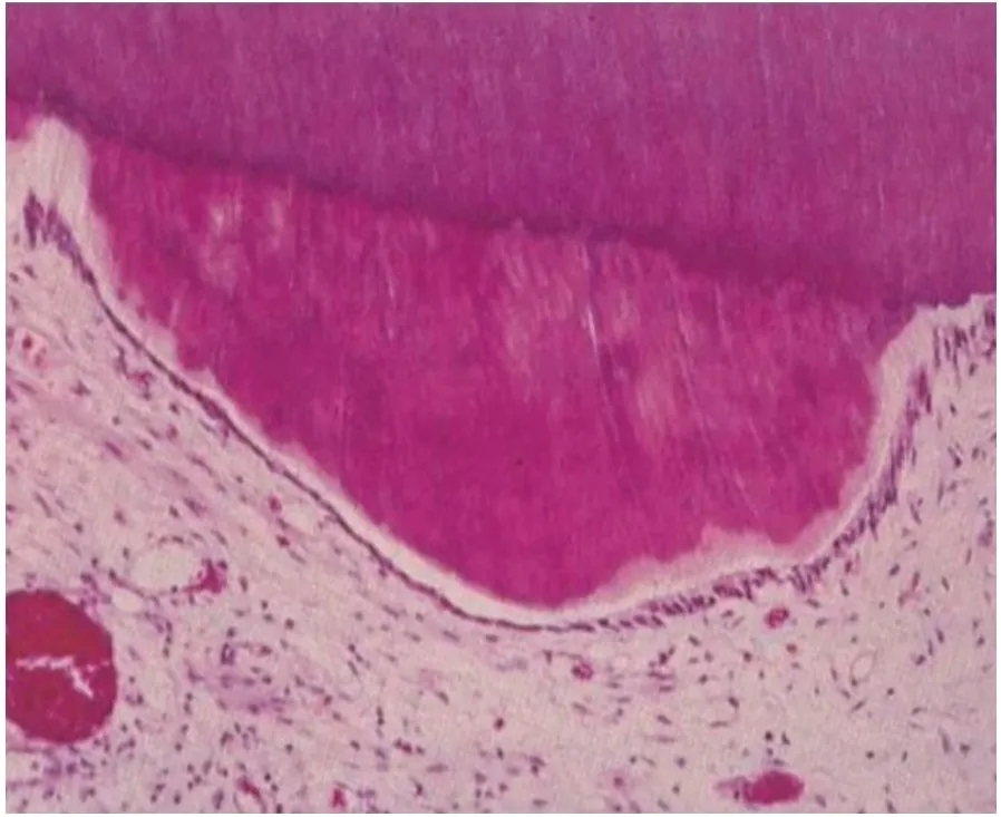 Is Sensitivity After Treatment Normal? Director Yoo Seung-yeon Answers Directly image 3