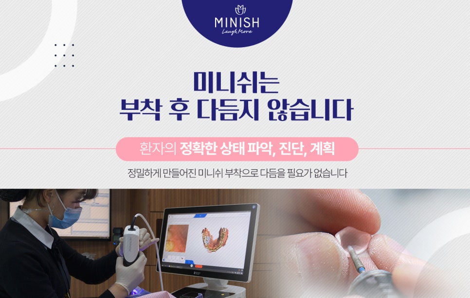 임시치아가 필요 없는 미니쉬 관련 이미지 4