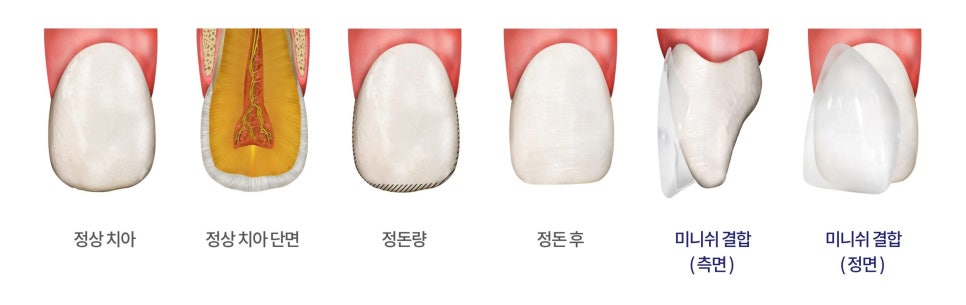 About 관련 이미지 13
