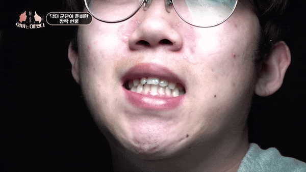 두 개여야 할 앞니가 한 개라면? [엄마는예뻤다 가평아들편] 관련 이미지 5