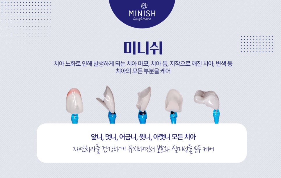 치아 수명 연장하는 법 관련 이미지 7