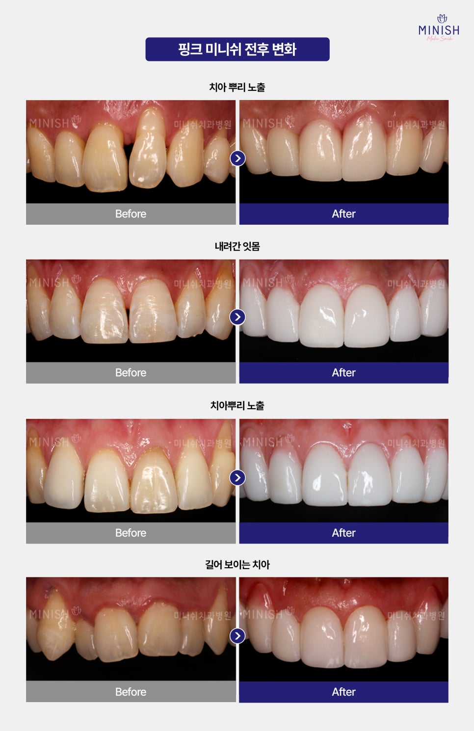 Gum Disease: Is It Just a Simple Problem? From Its Causes to Ways to Restore It image 6