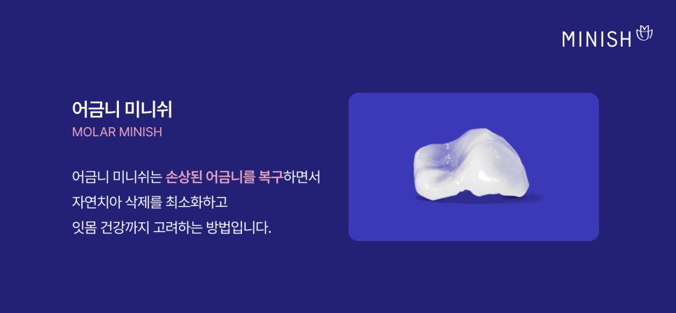 어금니 크라운 통증·깨짐·빠짐·교체, 재치료 고민이라면 어금니 미니쉬 관련 이미지 4
