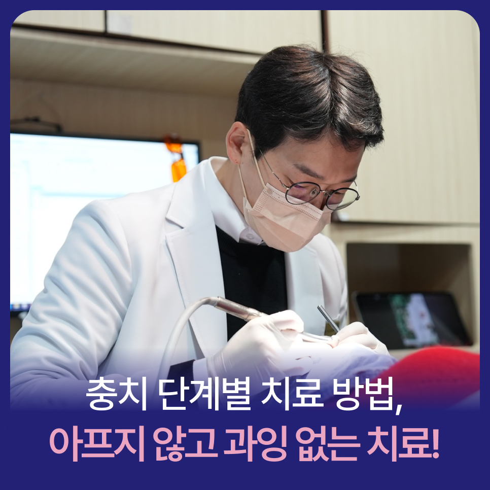 충치 단계별 치료 방법, 원데이 치료로 하루 만에 가능할까? 관련 이미지 1