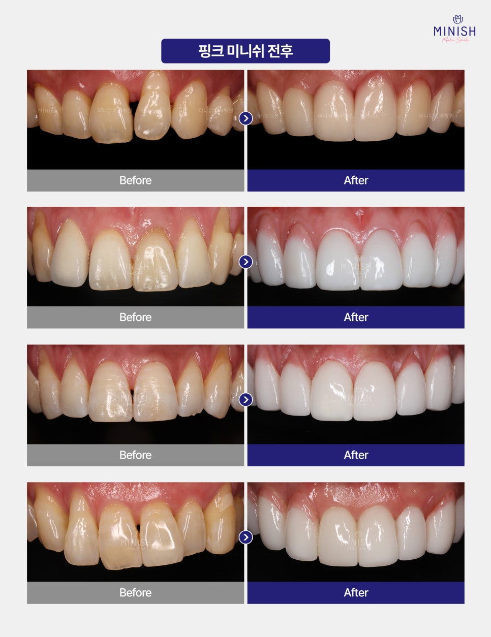 Bad Breath Causes: Could They Be More Serious Than You Think? A Summary of Solutions! image 11