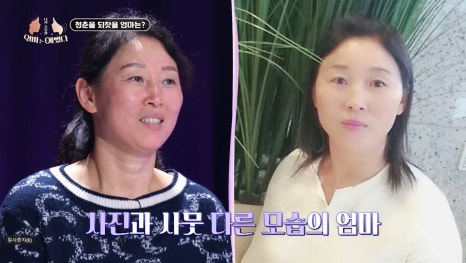 가평엄마 아들의 결손치, 미니쉬로 복원! [엄마는 예뻤다] 관련 이미지 2