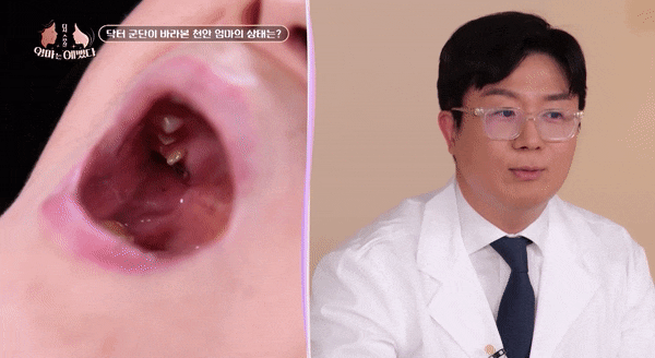 [엄마는 예뻤다] 나이가 들면, 치아도 노화됩니다 - 천안엄마편 관련 이미지 4
