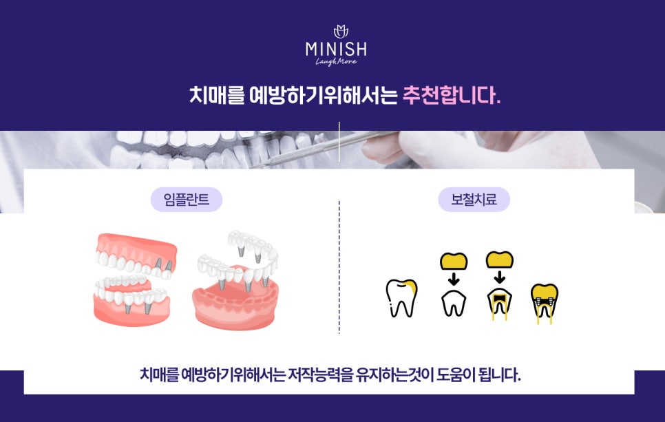 치아로 잘 씹지 못하면 치매 위험이 높아진다?! 관련 이미지 4