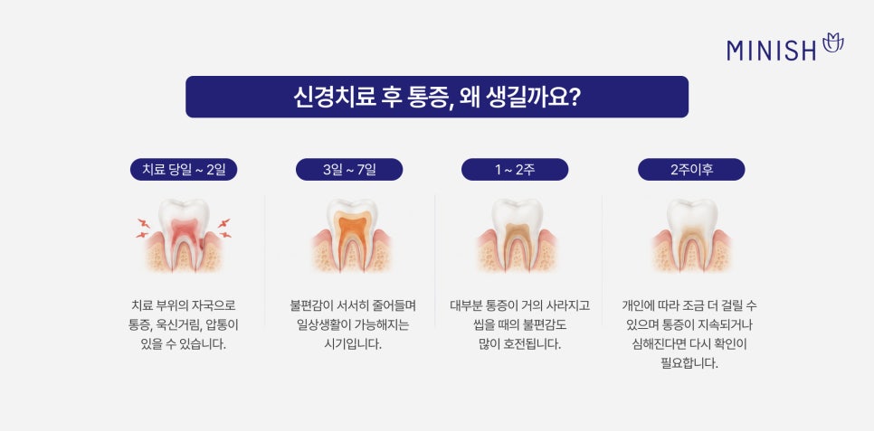 How Long Does Pain Last After Root Canal Treatment? If It Persists, Be Sure to Have It Checked! image 3