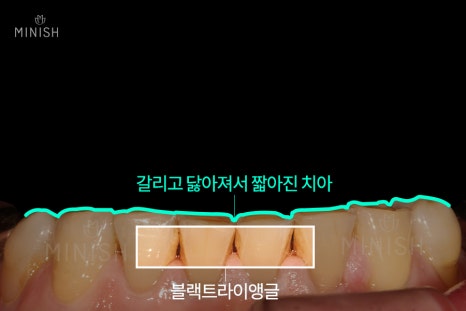 경기도엄마, 치아노화를 극복하다 [엄마는예뻤다] 관련 이미지 10