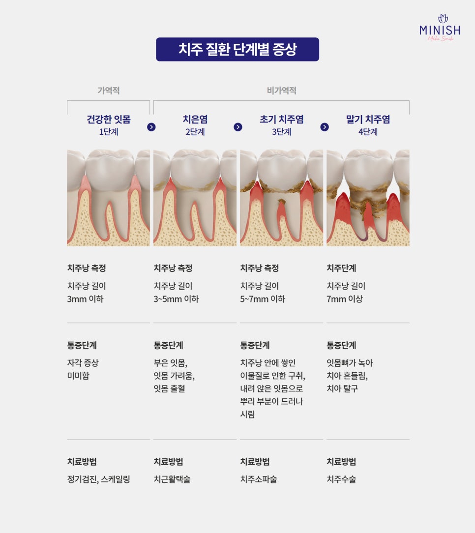 If Gum Swelling Continues, Suspect Periodontal Disease image 4