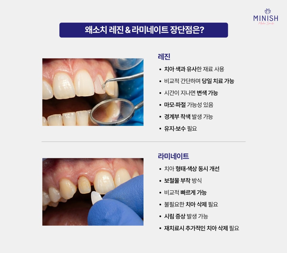 작은 치아, 왜소치 고민이라면? 하루 만에 개선할 수 있습니다 관련 이미지 3