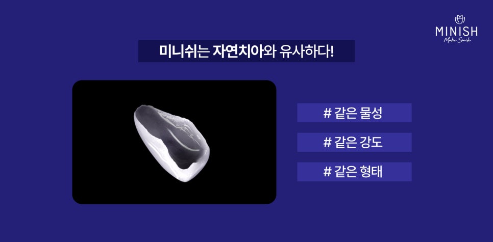 누런치아, 치아 미백으로 해결되지 않을 땐? 관련 이미지 12