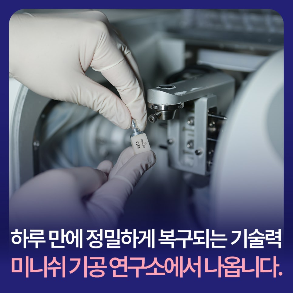 What Is the Technology Behind Minish’s Precise One-Day Restoration? It Comes from the Minish Dental Laboratory Research Center. image 1