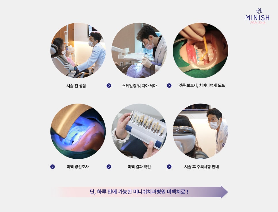누런치아, 치아 미백으로 해결되지 않을 땐? 관련 이미지 5