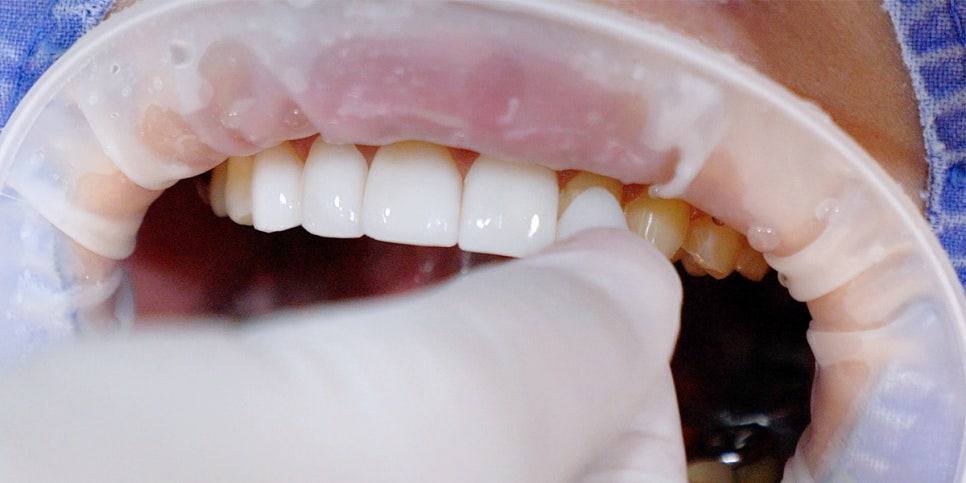 A 6-Year Minish Review from a Dentist, feat. Director Lee Jeong-eun image 10