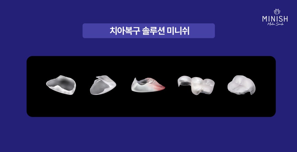 A Chipped Tooth: Which Treatment Should You Choose? A Comparison of Pros and Cons image 5