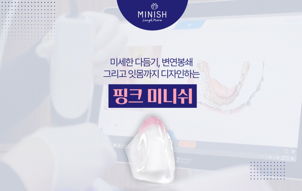오래된 크라운 재치료가 시급하다면, 미니쉬치과 관련 이미지 6