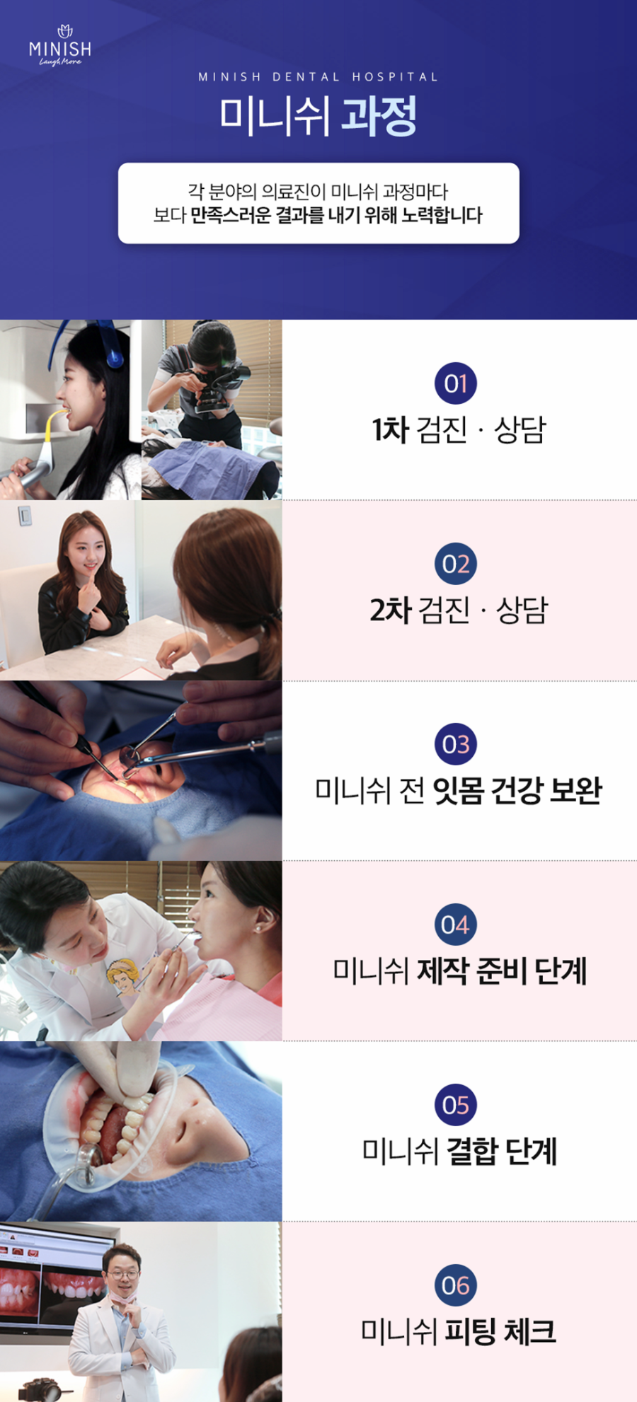 청담동치과 보다 정밀한 치아코팅으로 다양한 문제를 개선하는 미니쉬 관련 이미지 8