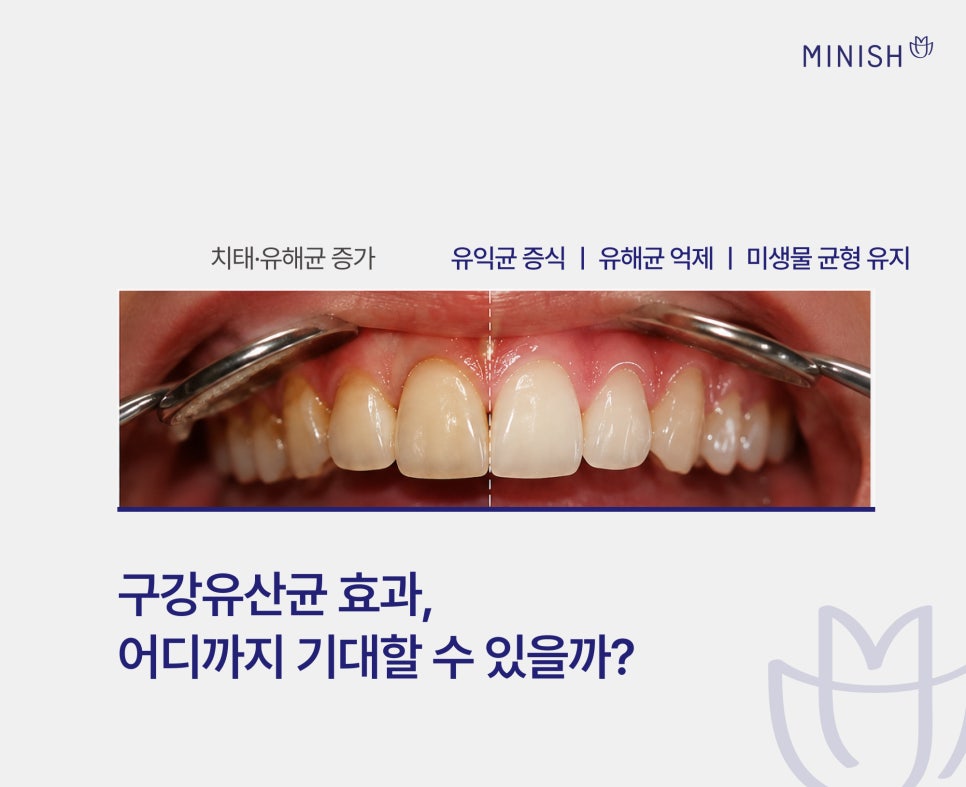 구강유산균 효과 있을까? 고르는 법과 섭취 전 알아둘 점 관련 이미지 3