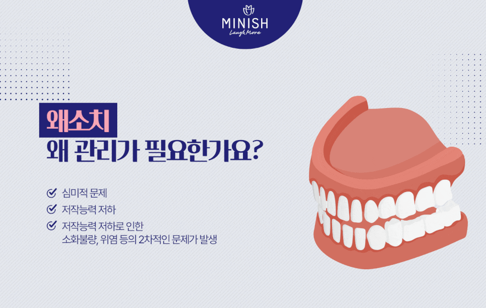 소중한 왜소치 지키는 법 관련 이미지 3
