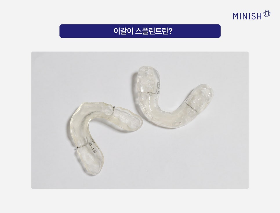 What Matters More Than the Price of a Bruxism Splint for Jaw Sounds: Criteria for Choosing a Temporomandibular Joint Dental Clinic image 4
