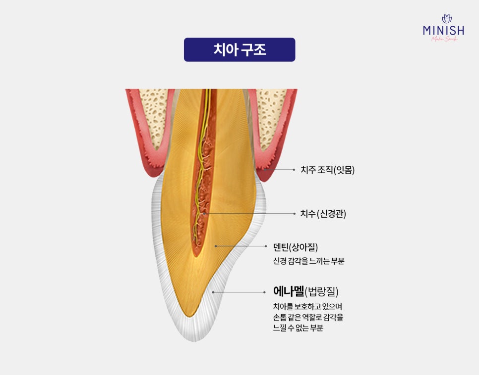 [Amelogenesis Imperfecta] If Your Teeth Wear Down and Break Easily, What Are the Treatment Options? Complete Guide image 2
