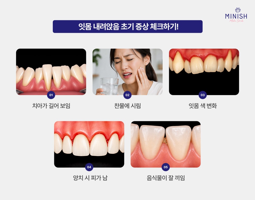 Causes of Receding Gums, Early Signs of Gum Disease, and When Gum Disease Treatment Is Needed image 3